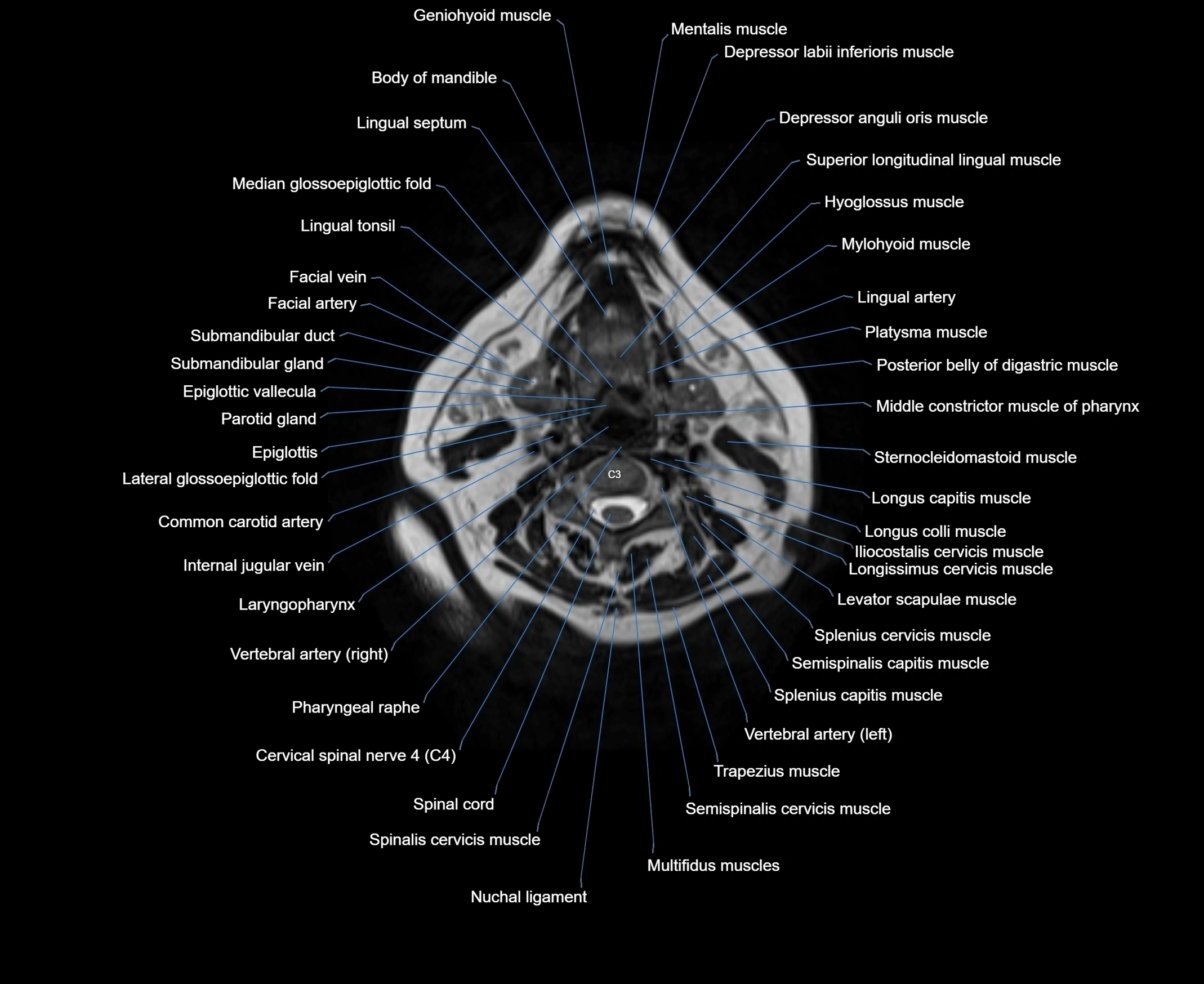 MRI Neck 3D labelled cross section anatomy axial 3t image-00001-00046.webp